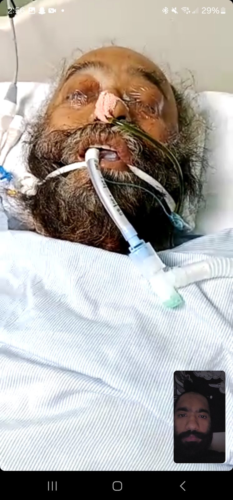 On a ventilator